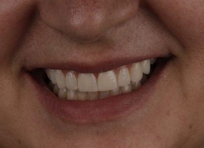 estética dental Motril