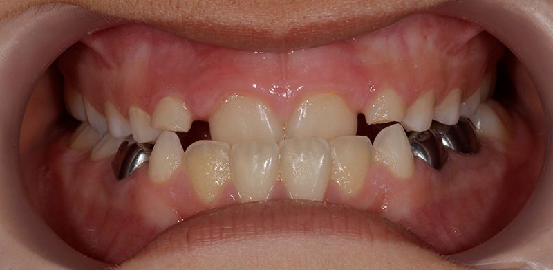 Ortodoncia en Motril